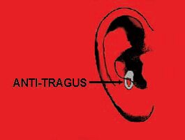 This is a picture of a piercing through the anti-tragus of the ear. The anti-tragus is located on the cartillage outside the ear canal.