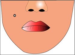 This is a picture of the cheek piercing. It consists of a stud which is pierced through the cheek, above the lips, but below the nose.