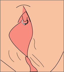 This is a picture of a clitoral piercing. It depicts a small ring pierced through the clitoris.