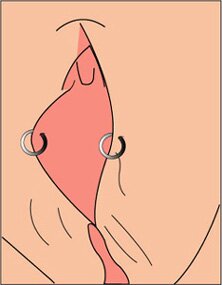 This is a picture of a labia piercing. It shows 2 ring piercings, one on each side of the outer labia.