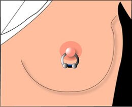 This is a picture of a nipple piercing. It shows a crescent shaped half ring pierced through the centre of the nipple, with two balls on both ends.