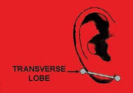 This is a picture of a transverse lobe piercing. The transverse lobe piercing consists of a barbell which is pierced through the lobe twice.